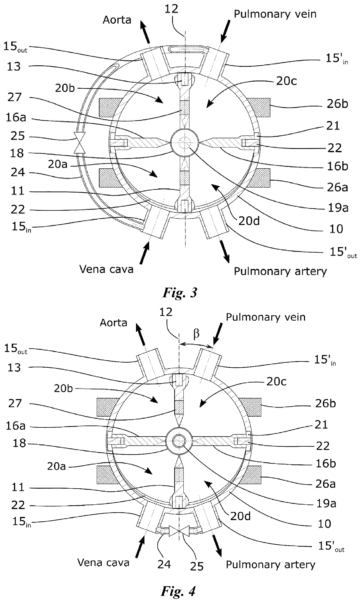 Artificial heart and its drive unit