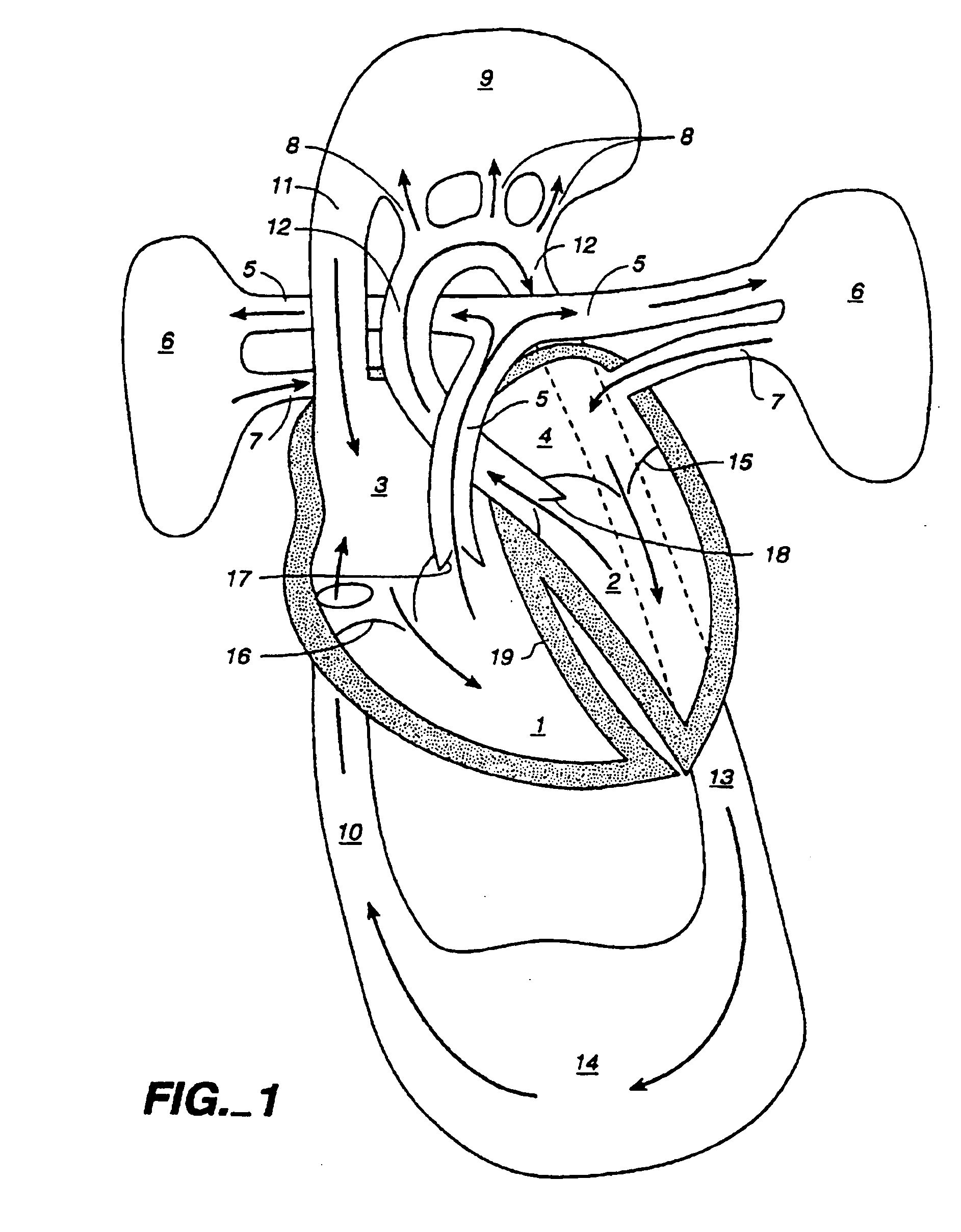 Multichannel catheter