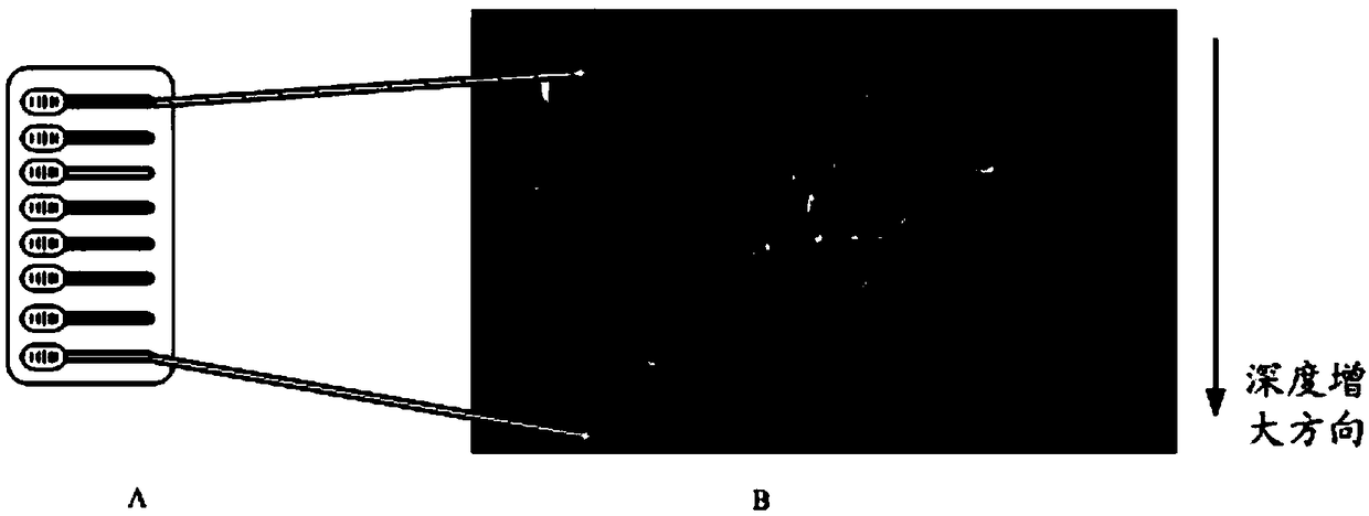 Ultrasonic image processing method, device, storage medium, and ultrasonic imaging device