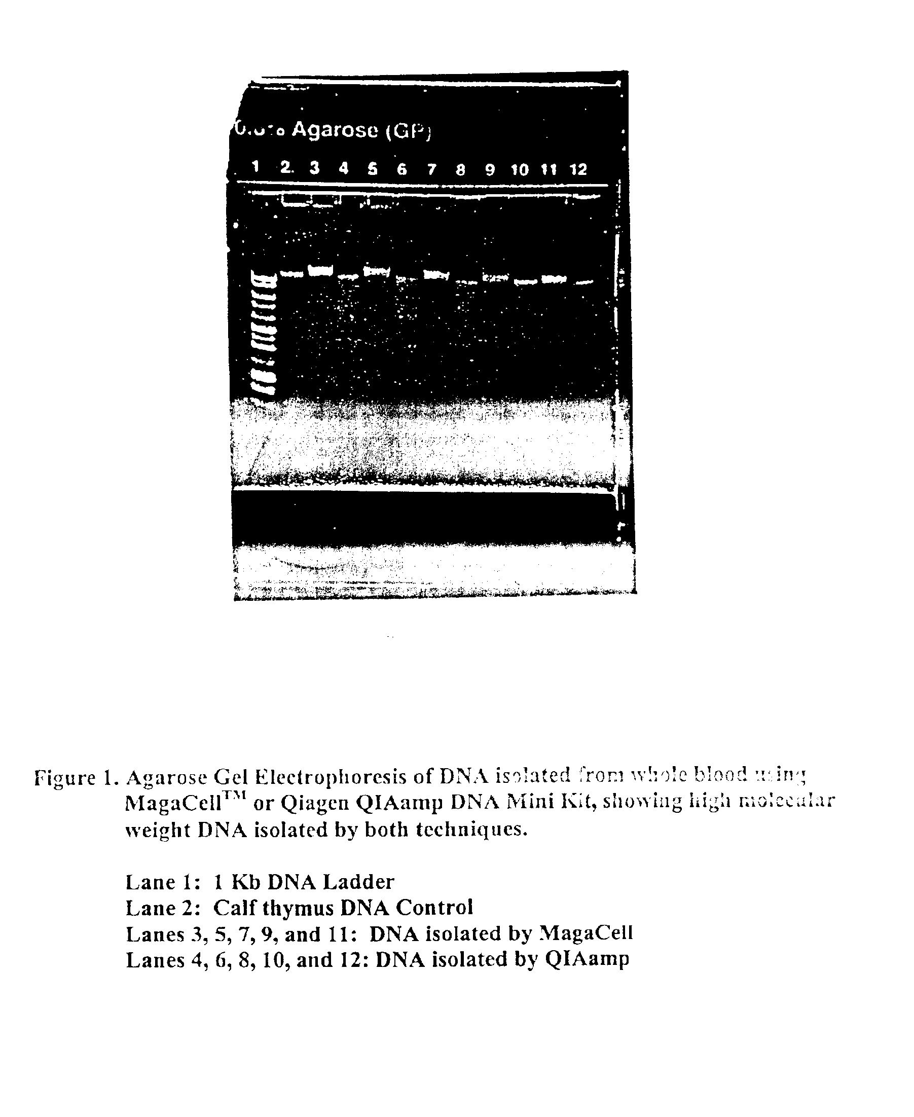 Magnetic isolation and purification of nucleic acids