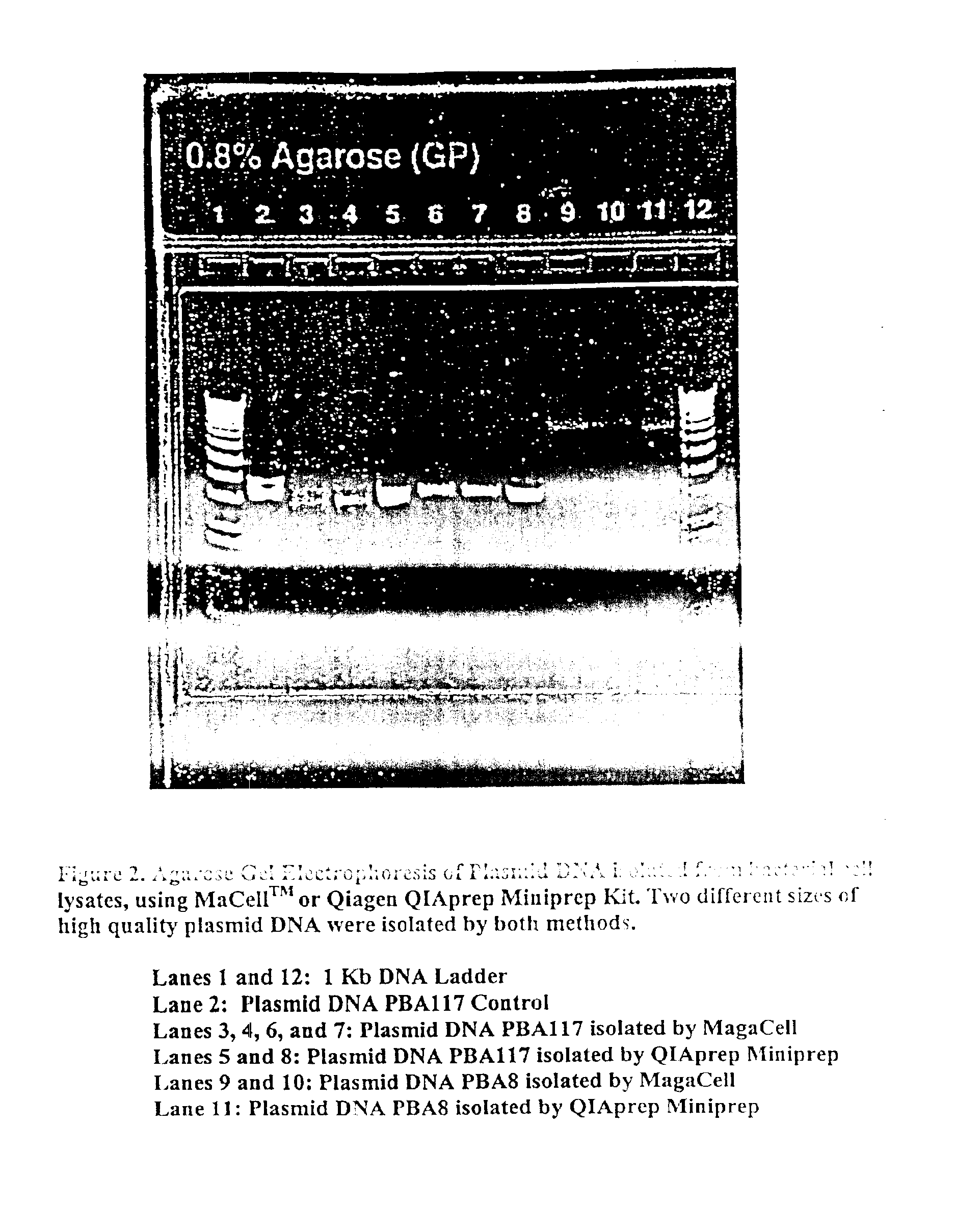 Magnetic isolation and purification of nucleic acids