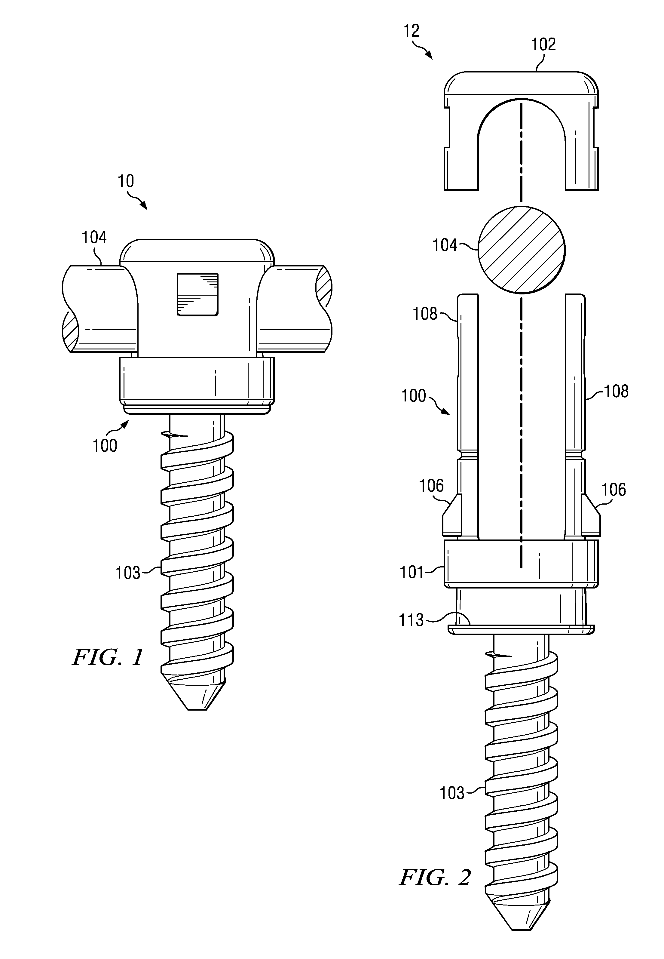 Spinal Implant