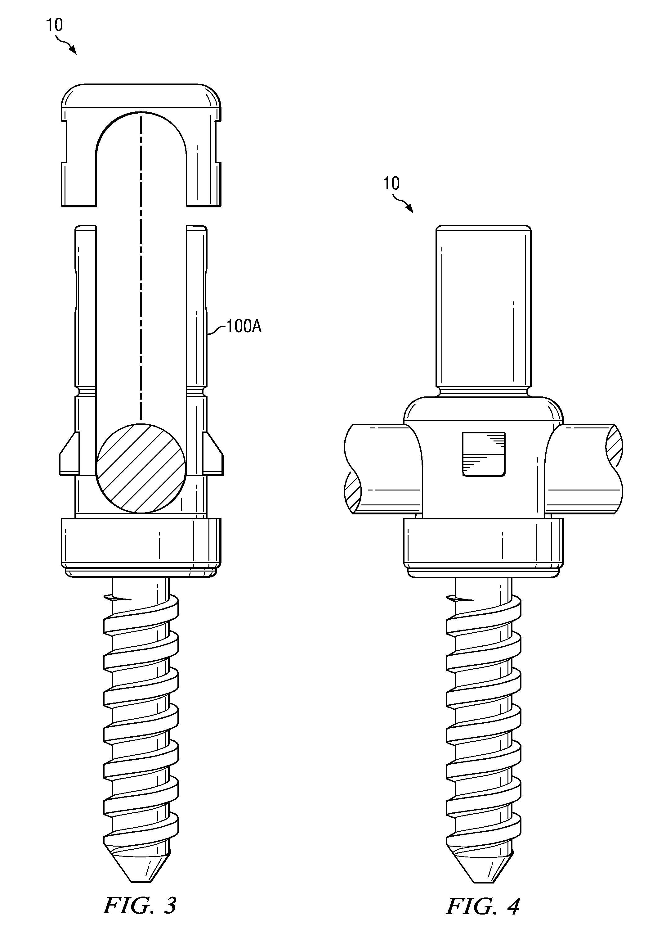 Spinal Implant