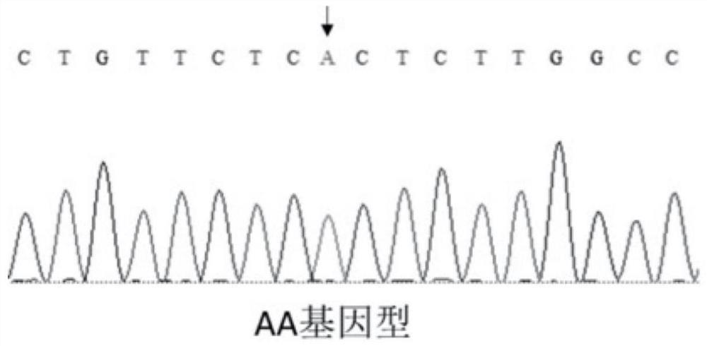 A SNP molecular marker affecting pig muscle fiber diameter and its application