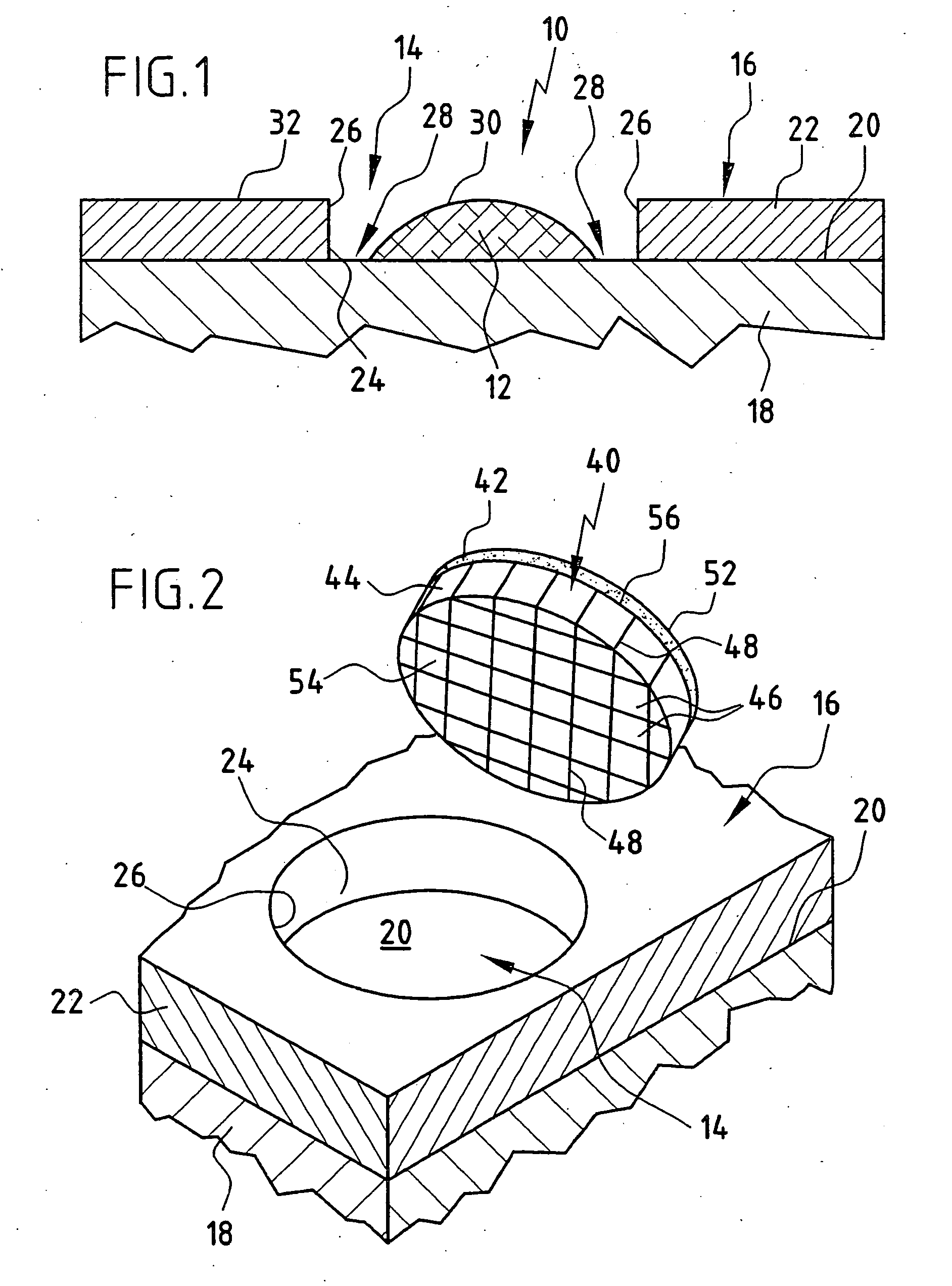 Cartilage replacement implant and method for producing a cartilage replacement implant