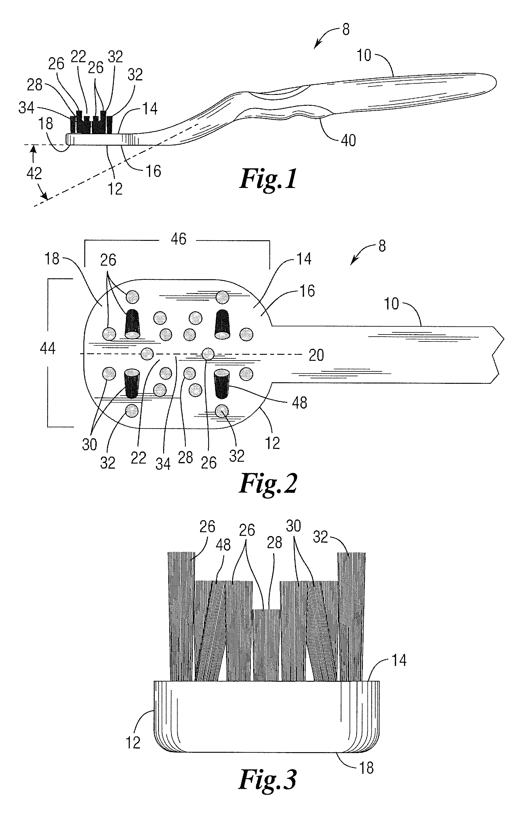 Orthodontic toothbrush