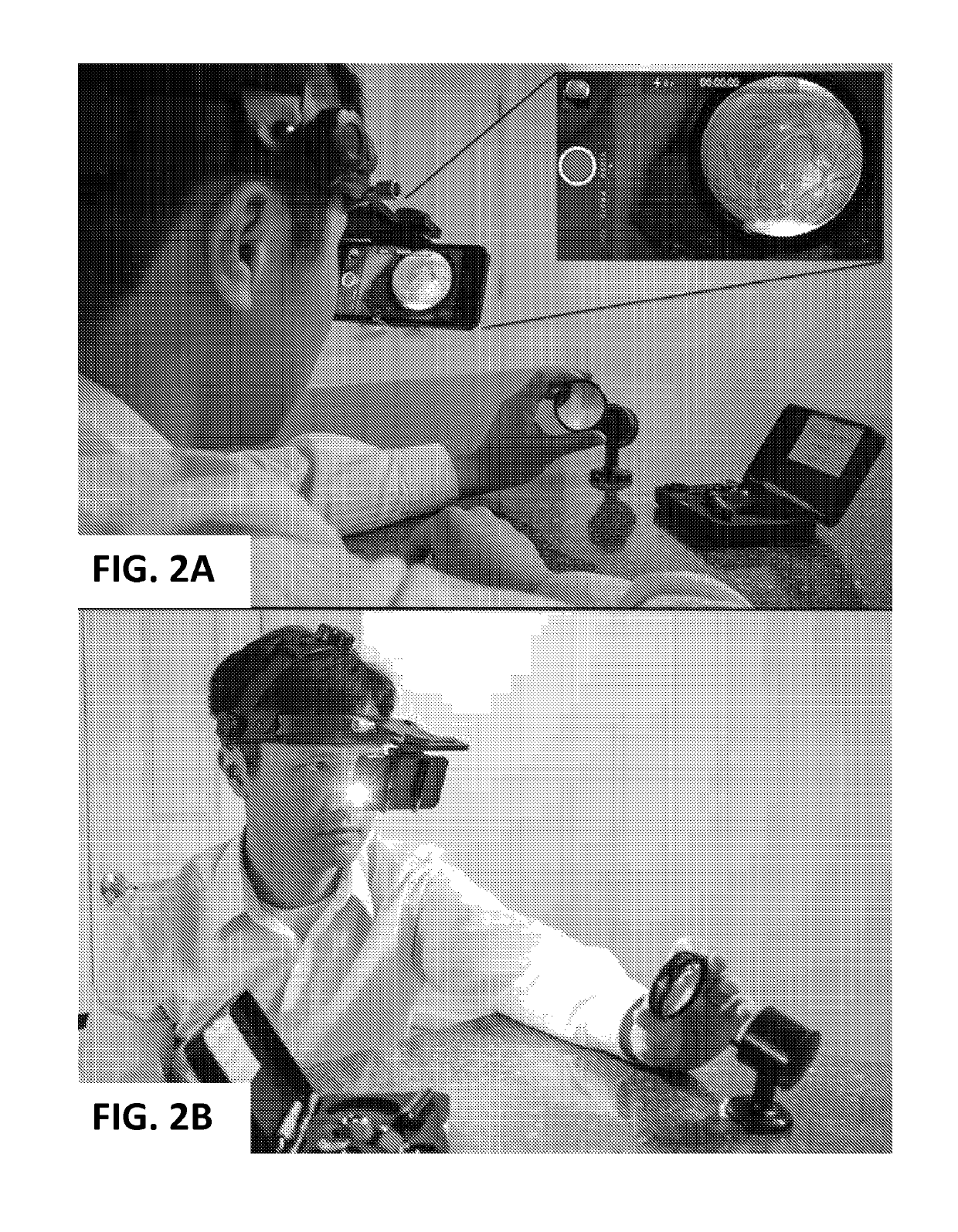 Head-mounted indirect opthalmoscope camera