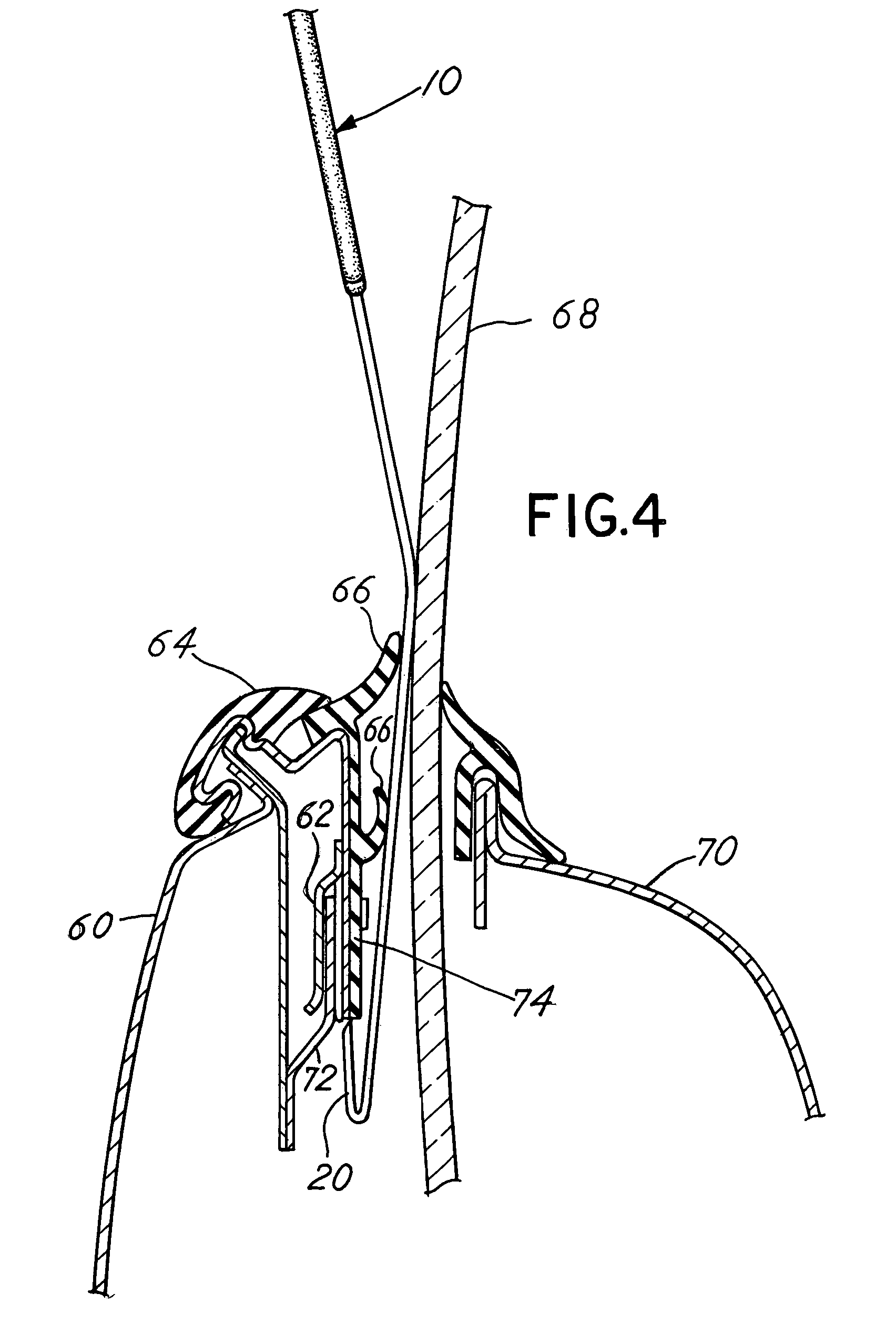 Window belt molding removal tool