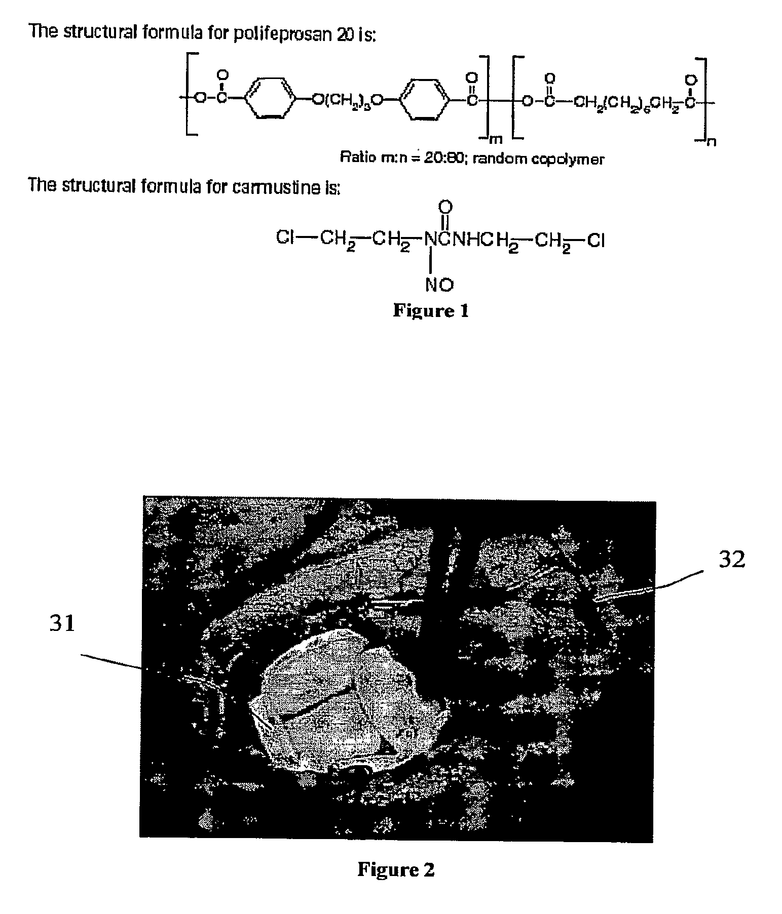 System and Method for Intracranial Implantation of Therapeutic or Diagnostic Agents