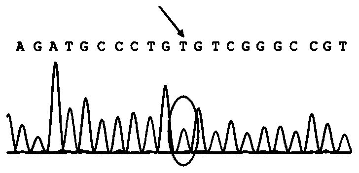 Primer for detecting congenital renal diabetes insipidus AVPR2 gene mutation, method thereof and kit