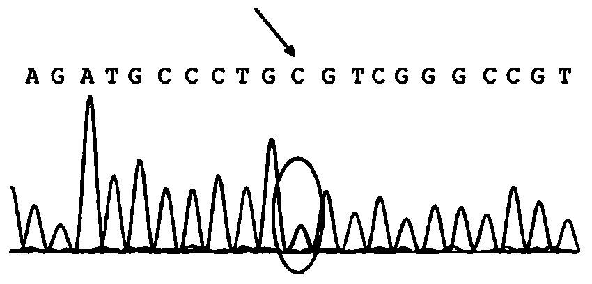 Primer for detecting congenital renal diabetes insipidus AVPR2 gene mutation, method thereof and kit