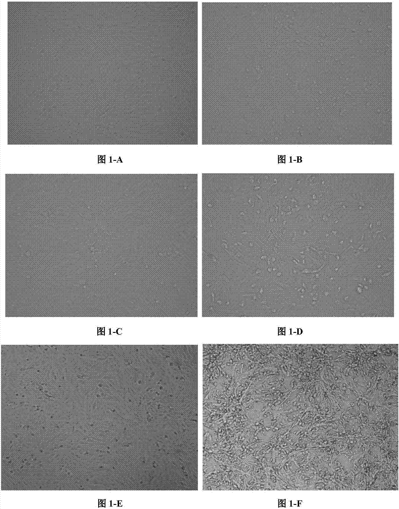 Porcine epidemic diarrhea virus inactivated vaccine and preparation method thereof