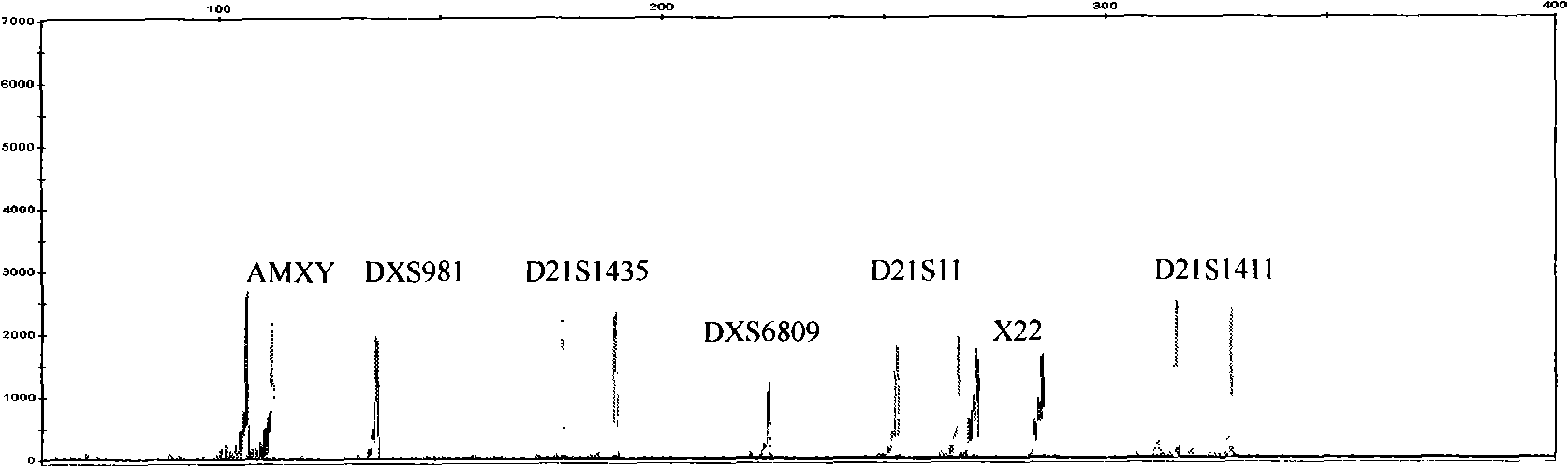 Reagent box for detecting No 21 chromosome and idiochromosome number abnormality