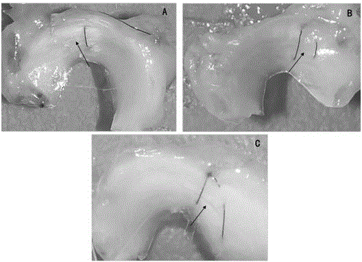 A kind of tissue engineering meniscus repair sheet and preparation method thereof