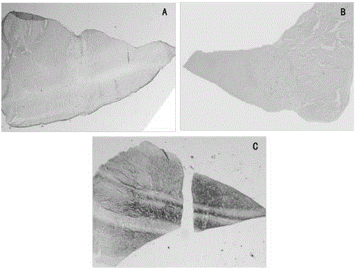 A kind of tissue engineering meniscus repair sheet and preparation method thereof