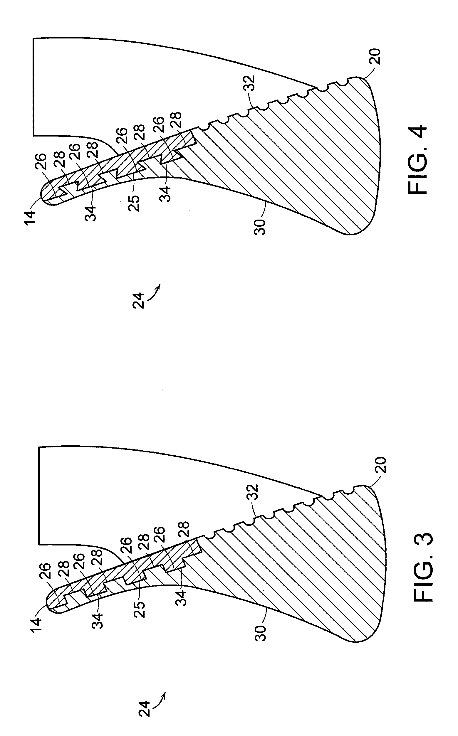 Multi-metal golf clubs