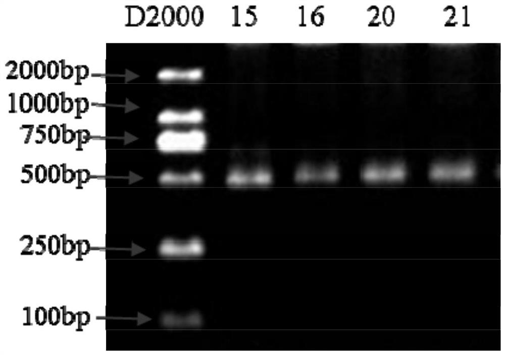 A kind of method and detection kit for nasal flora detection