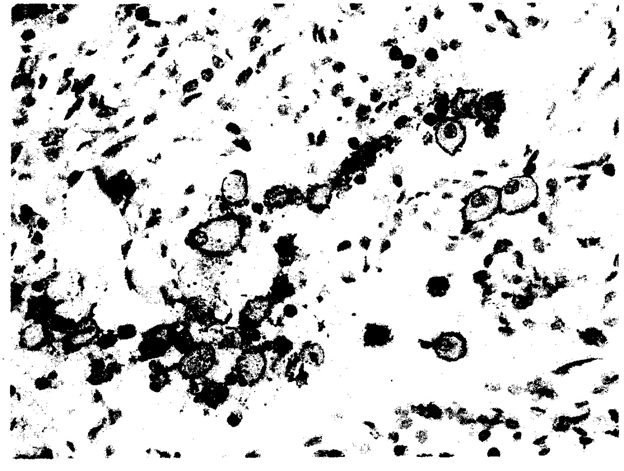 Mouse anti-human TIM3 (T cell immunoglobulin domain and mucin domain protein 3) monoclonal antibody and immunohistochemical application thereof