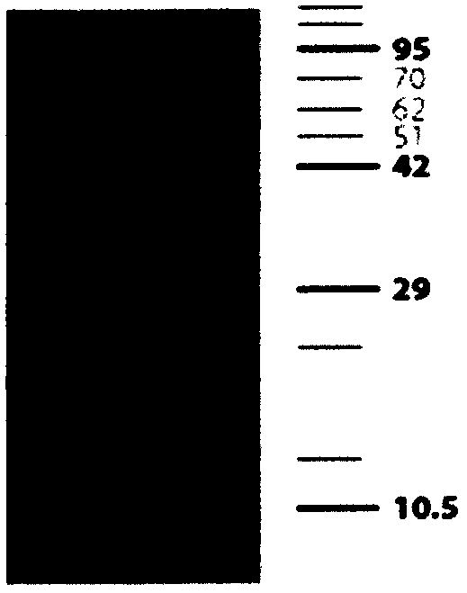 Mouse anti-human TIM3 (T cell immunoglobulin domain and mucin domain protein 3) monoclonal antibody and immunohistochemical application thereof