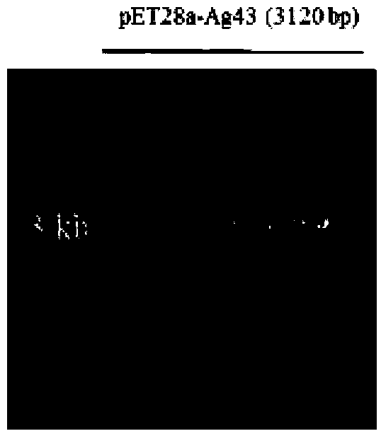 Recombinant plasmid pET28a-Ag43, surface display plasmid, recombinant engineering bacteria and application thereof