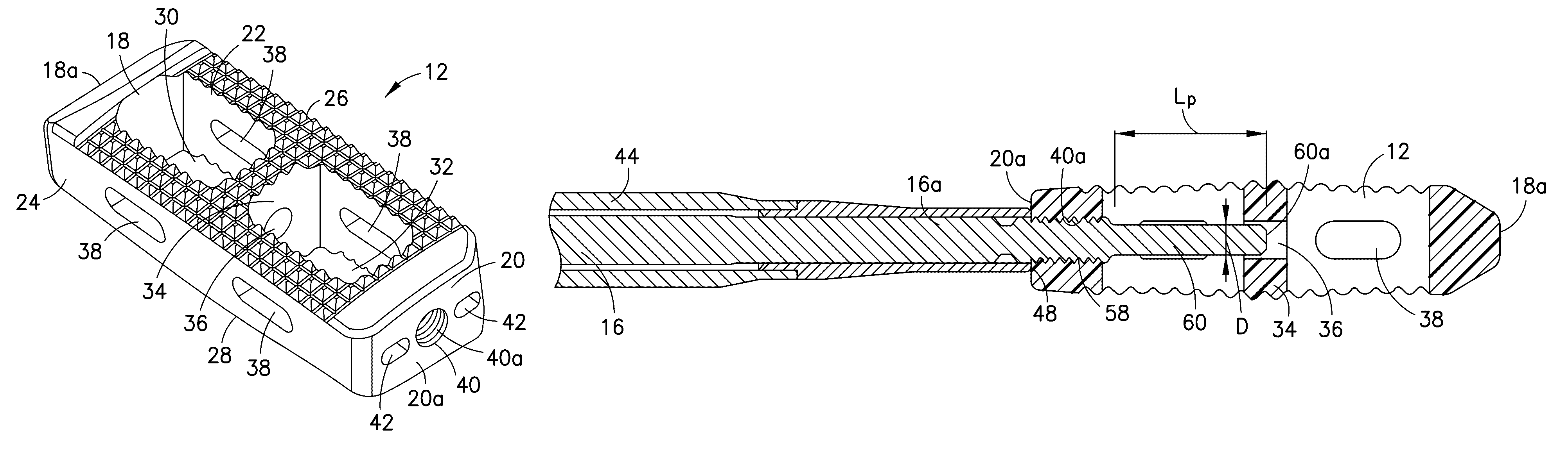 Apparatus for locating the position of a spinal implant during surgery