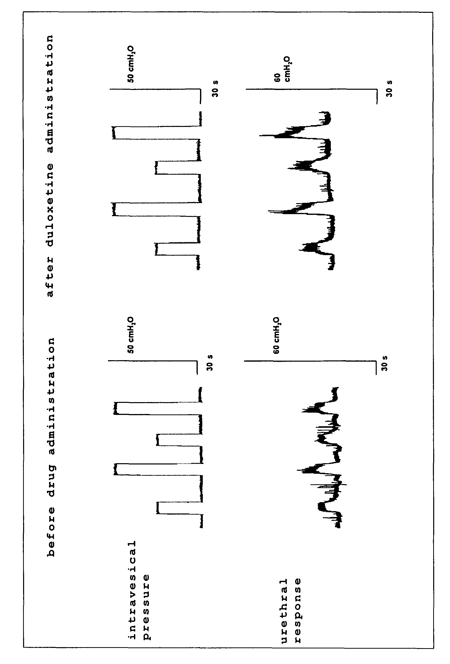 Preventives/remedies for stress urinary incontinence and method of screening the same