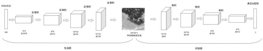 Medical image synthesis and classification method based on conditional multi-discriminant generative adversarial network