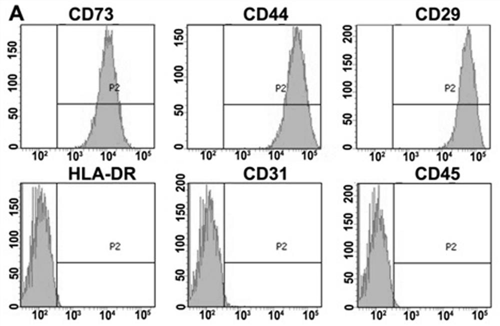 Identification and application of human amniotic mesenchymal stem cell exocrine protein POSTN