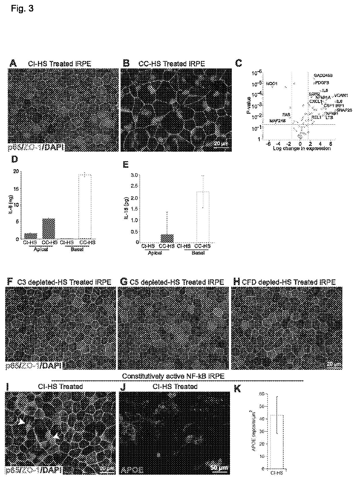 Druggable target to treat retinal degeneration