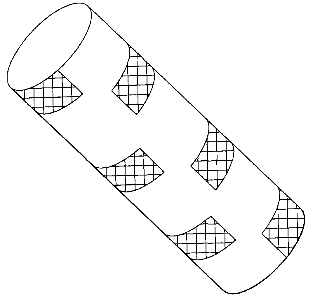 Anti-migration features and geometry for a shape memory polymer stent