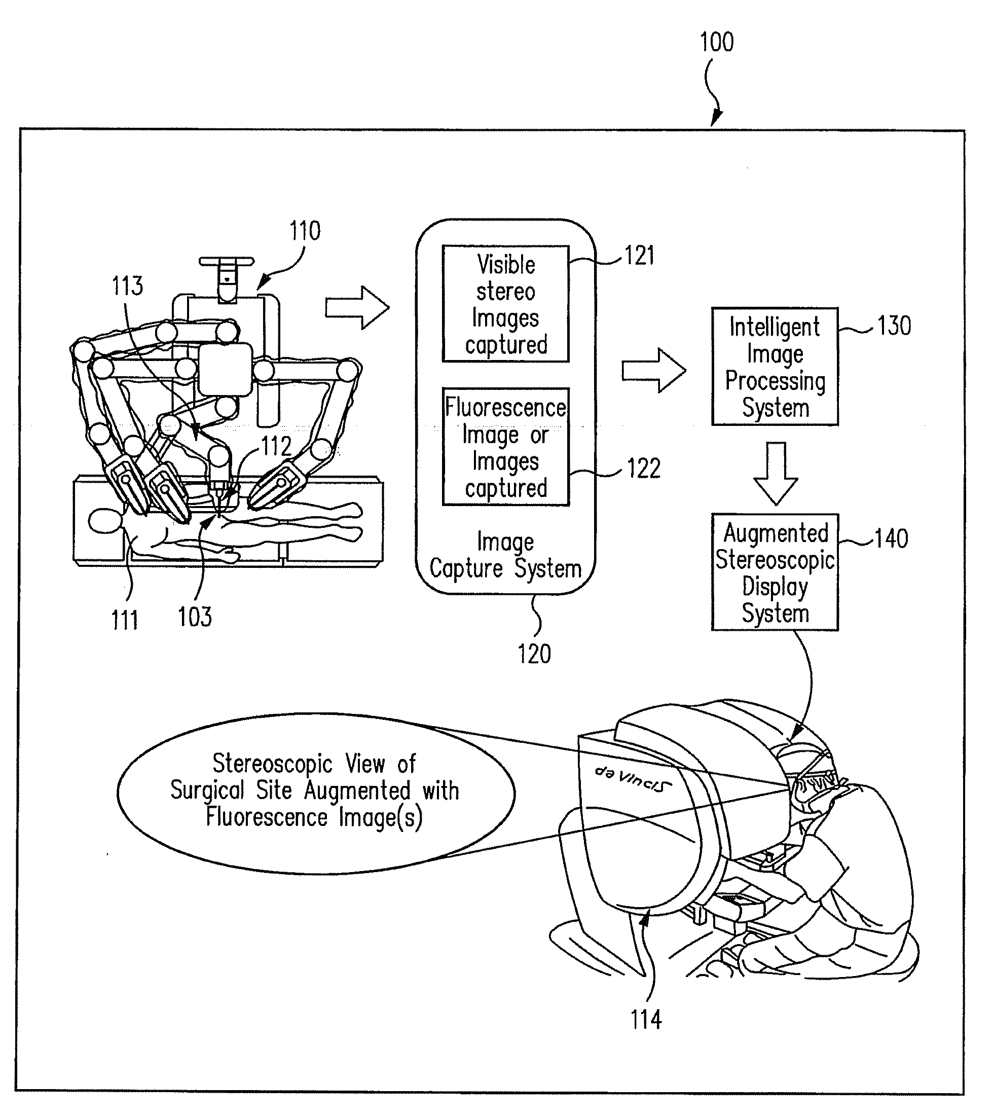 Augmented stereoscopic visualization for a surgical robot using time duplexing