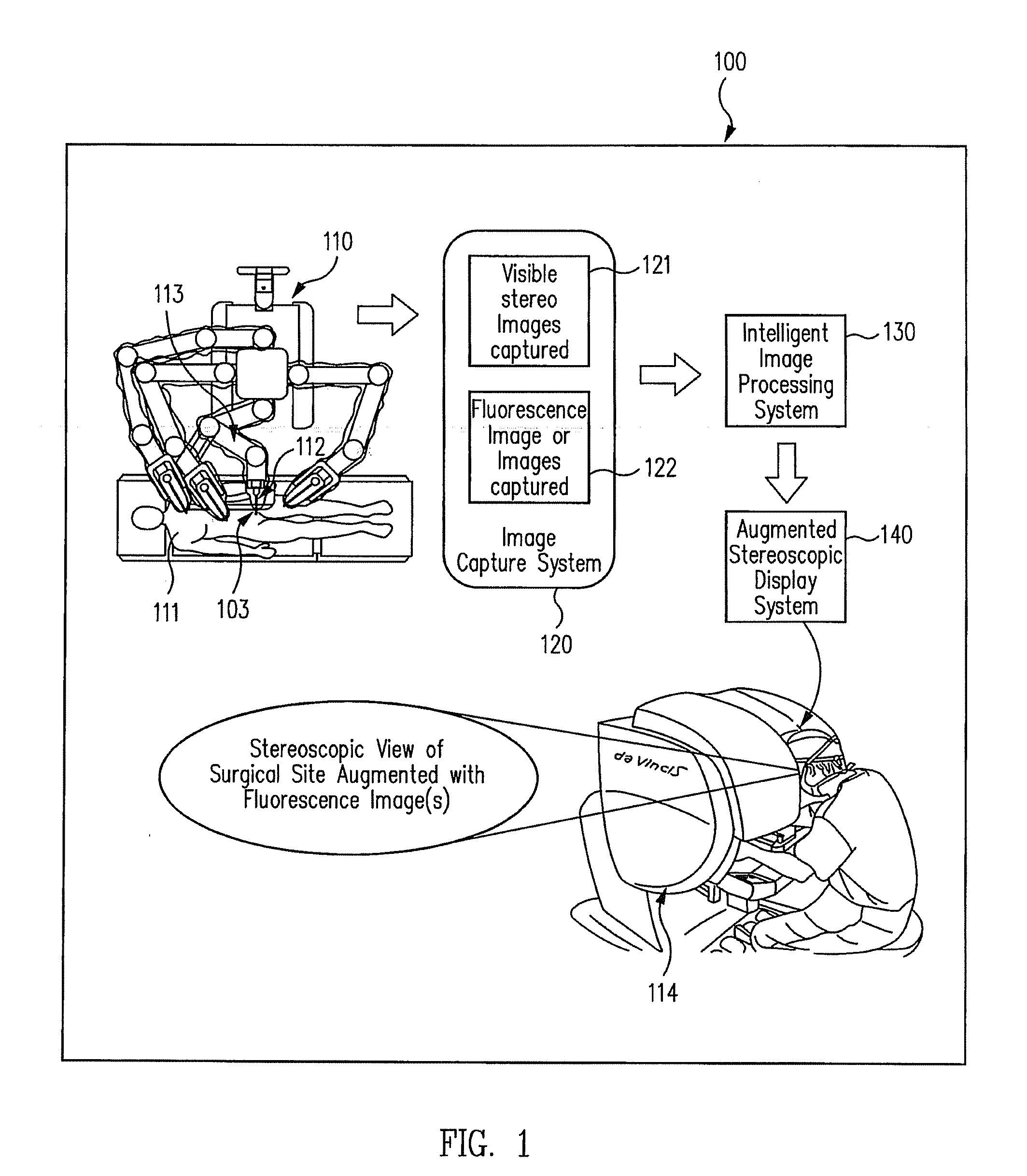 Augmented stereoscopic visualization for a surgical robot using time duplexing