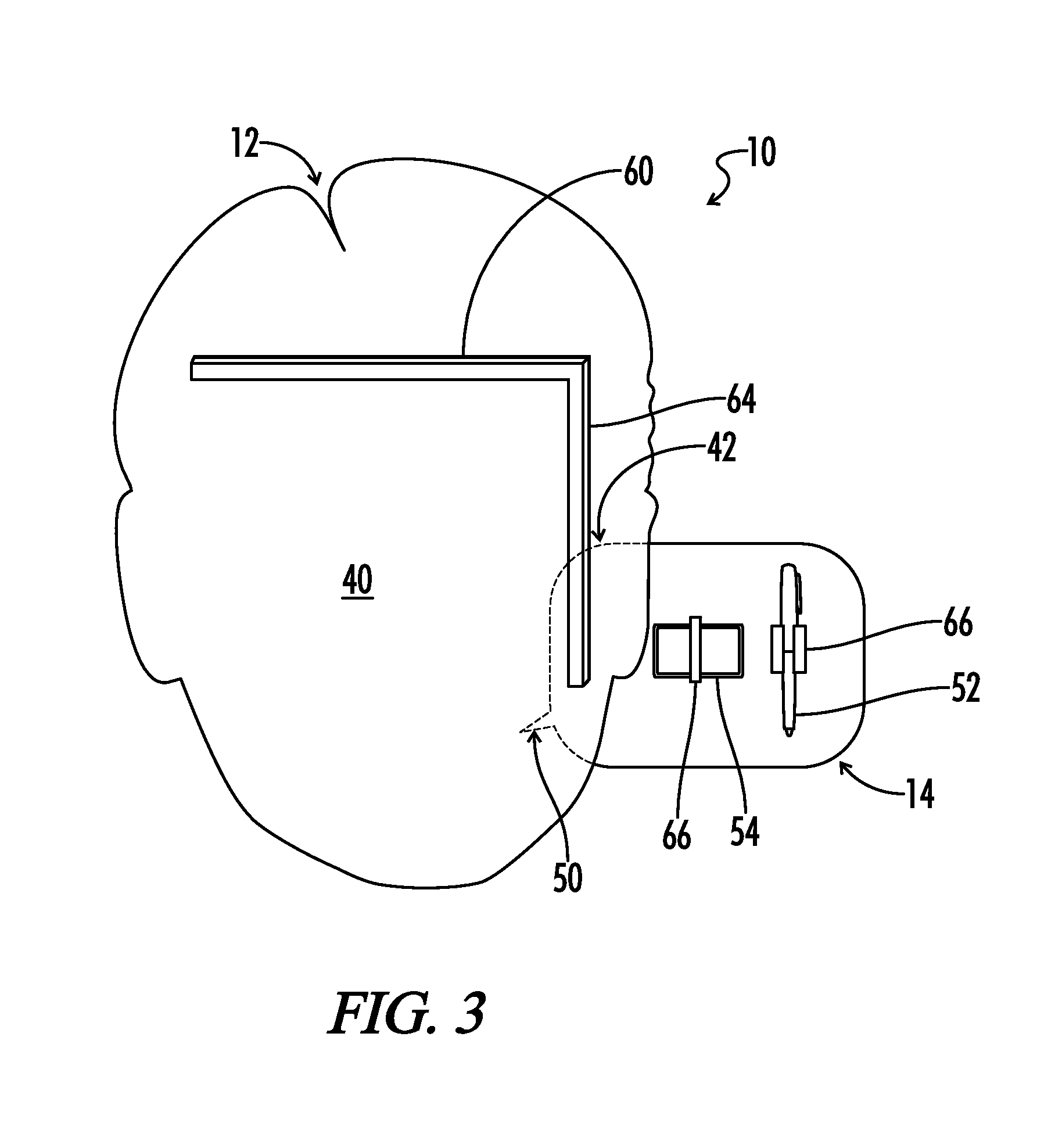 Method and device for real time expression