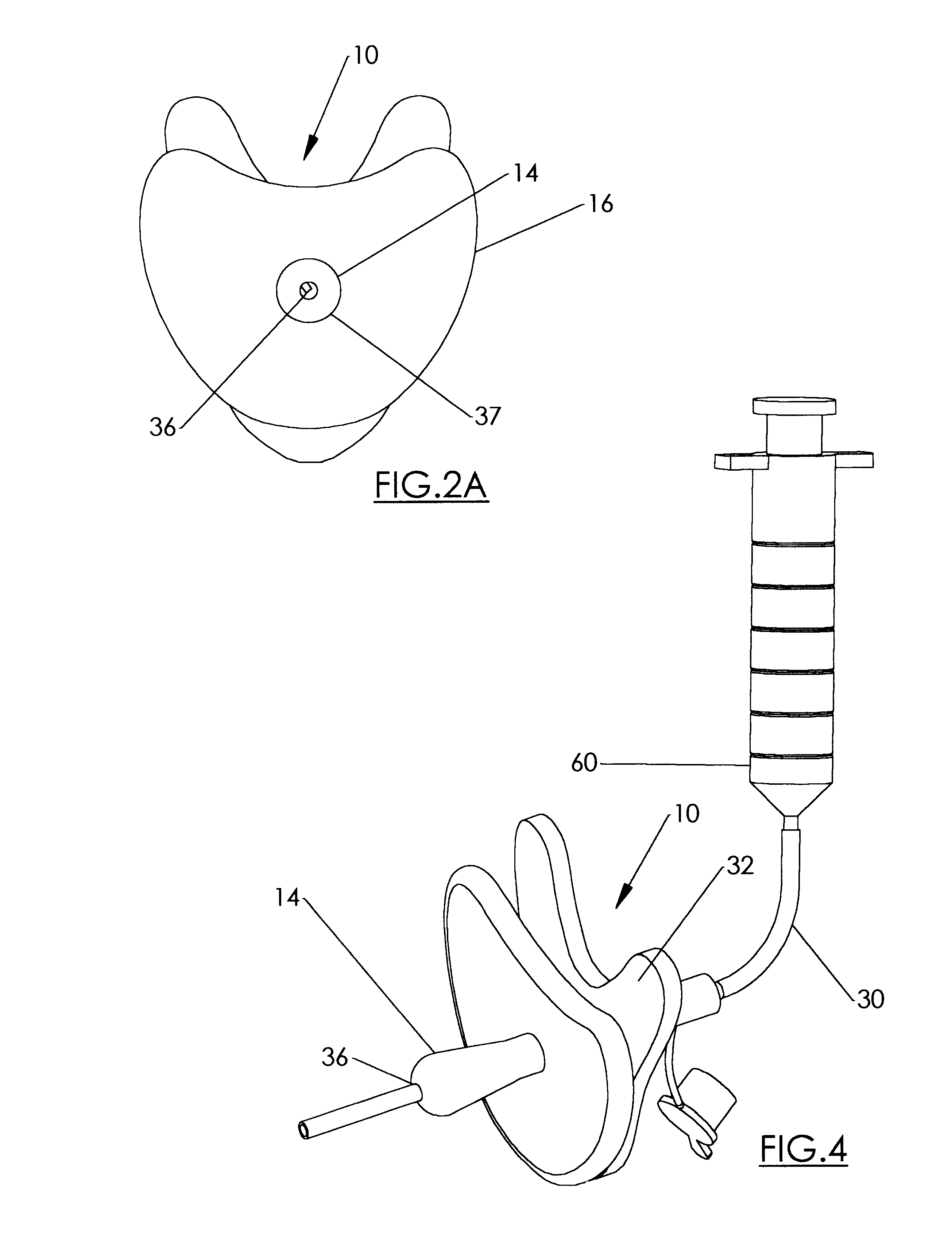 Feeding system and apparatus for infants