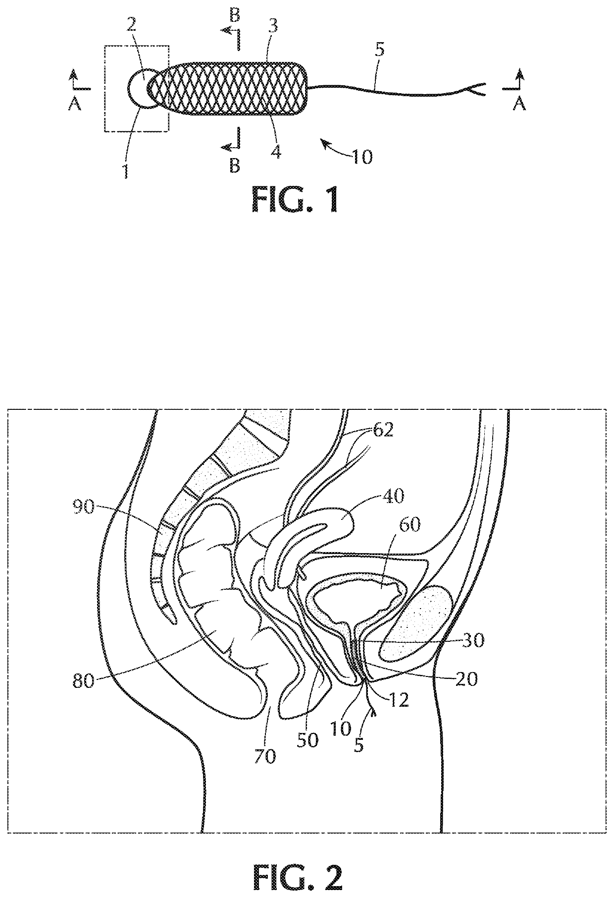 Urinary Plug Device