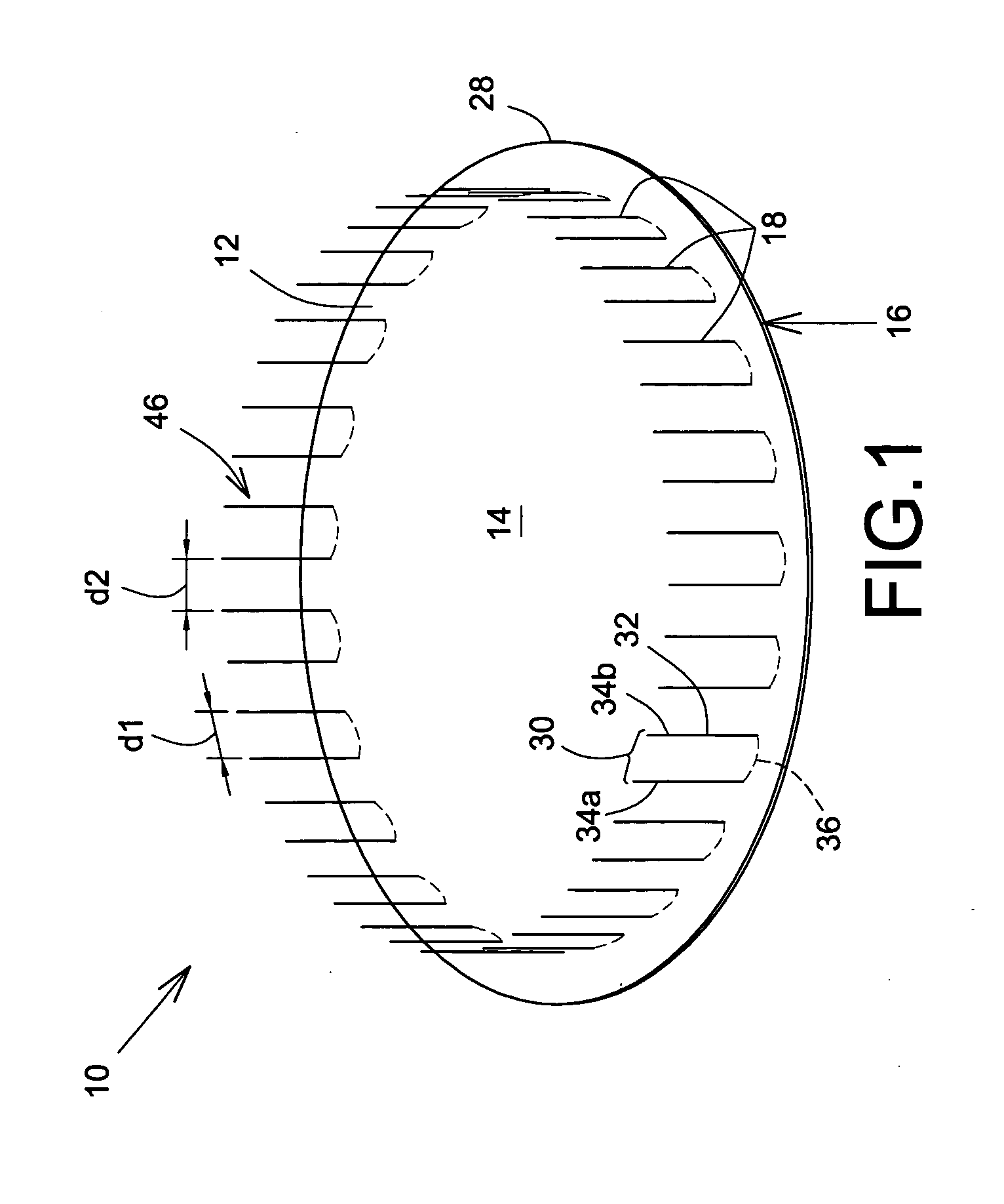 Prosthetic repair patch with integrated sutures