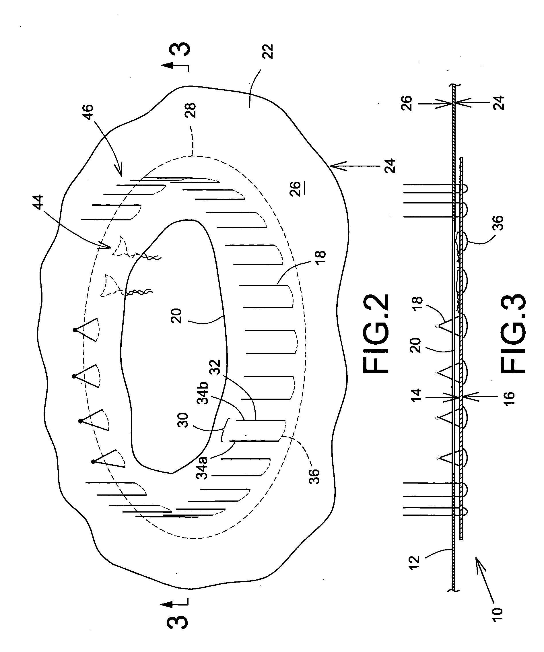 Prosthetic repair patch with integrated sutures