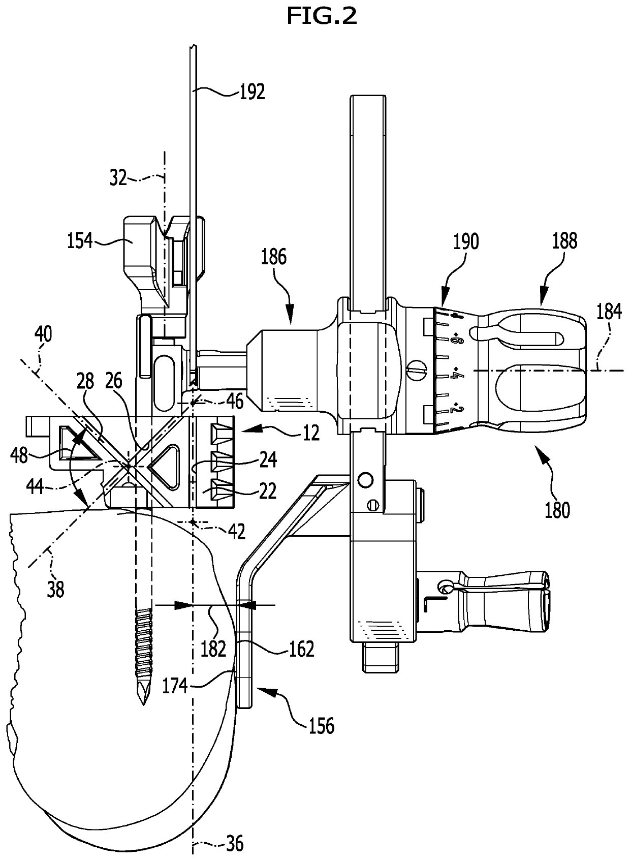 Surgical instrumentarium