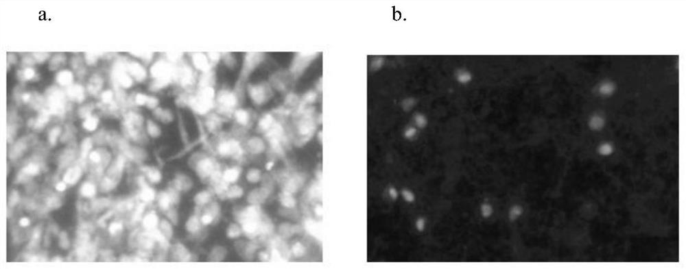 Viscous biological sample digestive agent and preparation method thereof