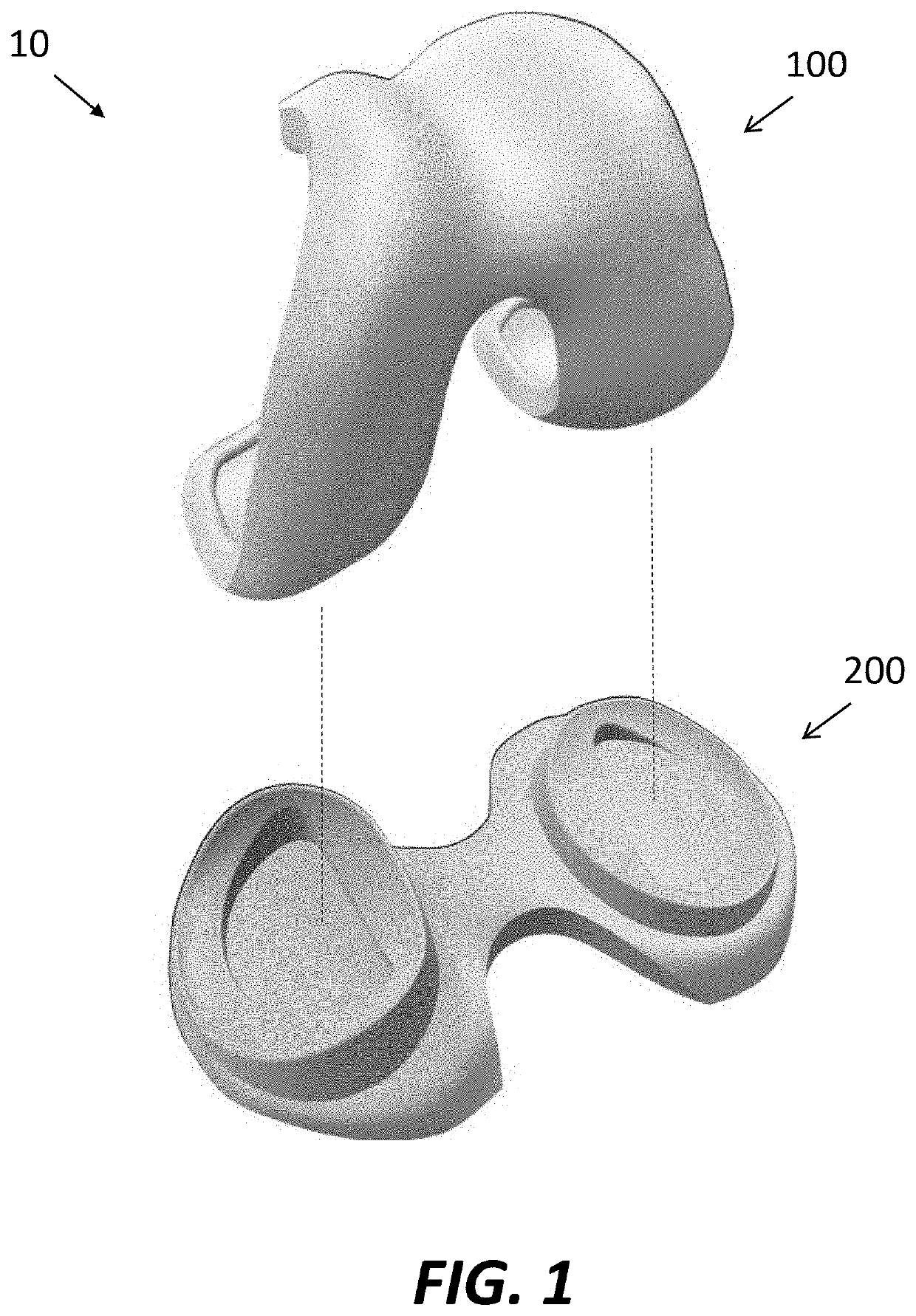 Patient specific composite knee replacement