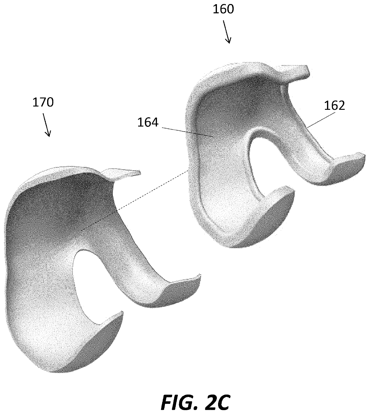 Patient specific composite knee replacement