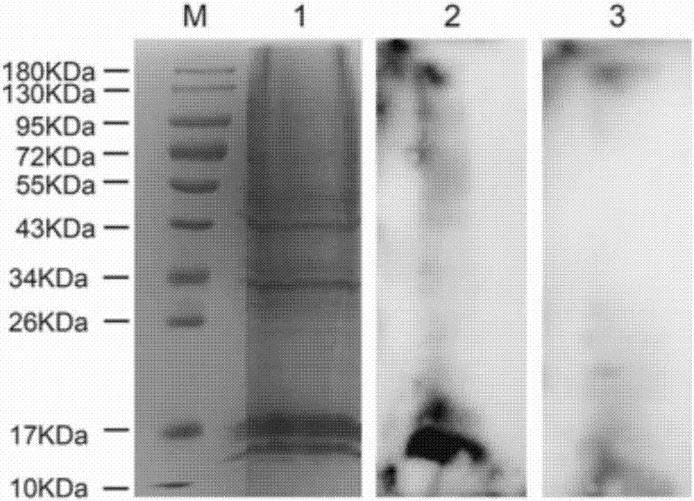 Receptor protein interacted with mycoplasma genitalium MgPa and separating method and application thereof