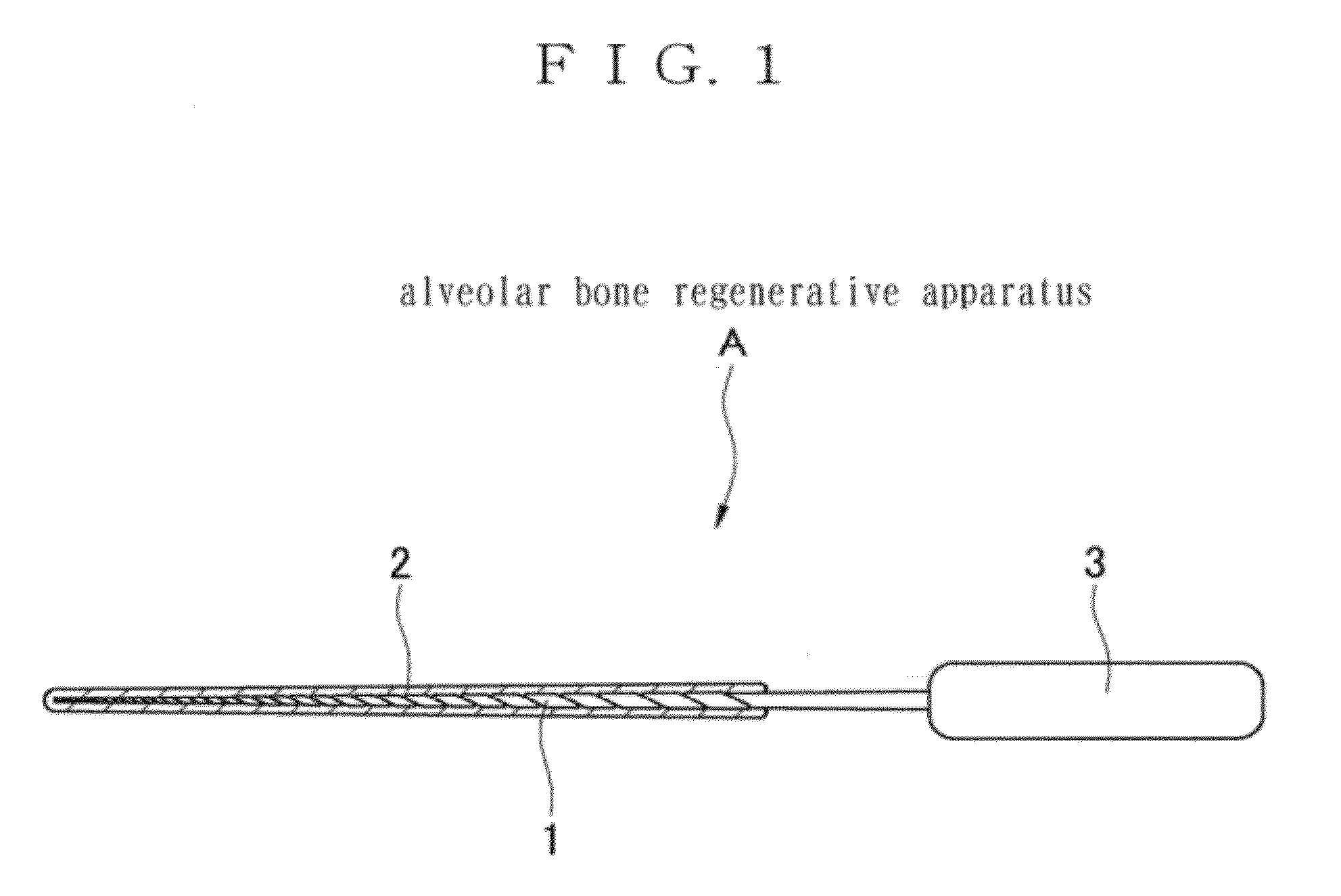 Alveolar bone regenerative apparatus