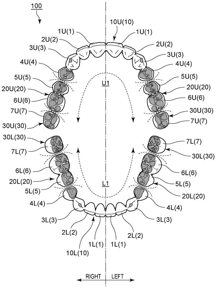 PARTIALLY CONNECTED COMPLETIVE ARTIFICIAL TOOTH HAVING ADJUSTMENT OF dental arch and occlusion bend