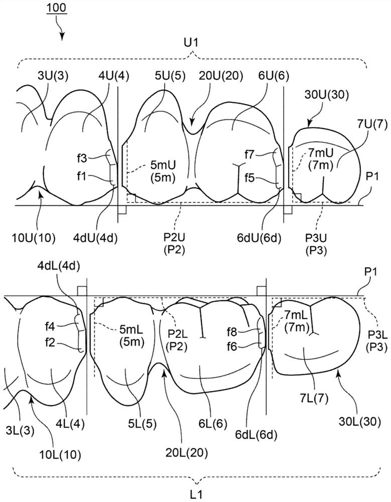 PARTIALLY CONNECTED COMPLETIVE ARTIFICIAL TOOTH HAVING ADJUSTMENT OF dental arch and occlusion bend