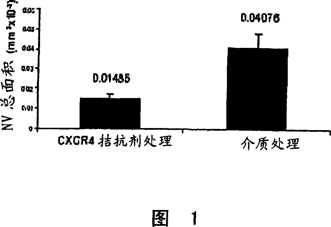 Compositions and methods for treating ophthalmic diseases