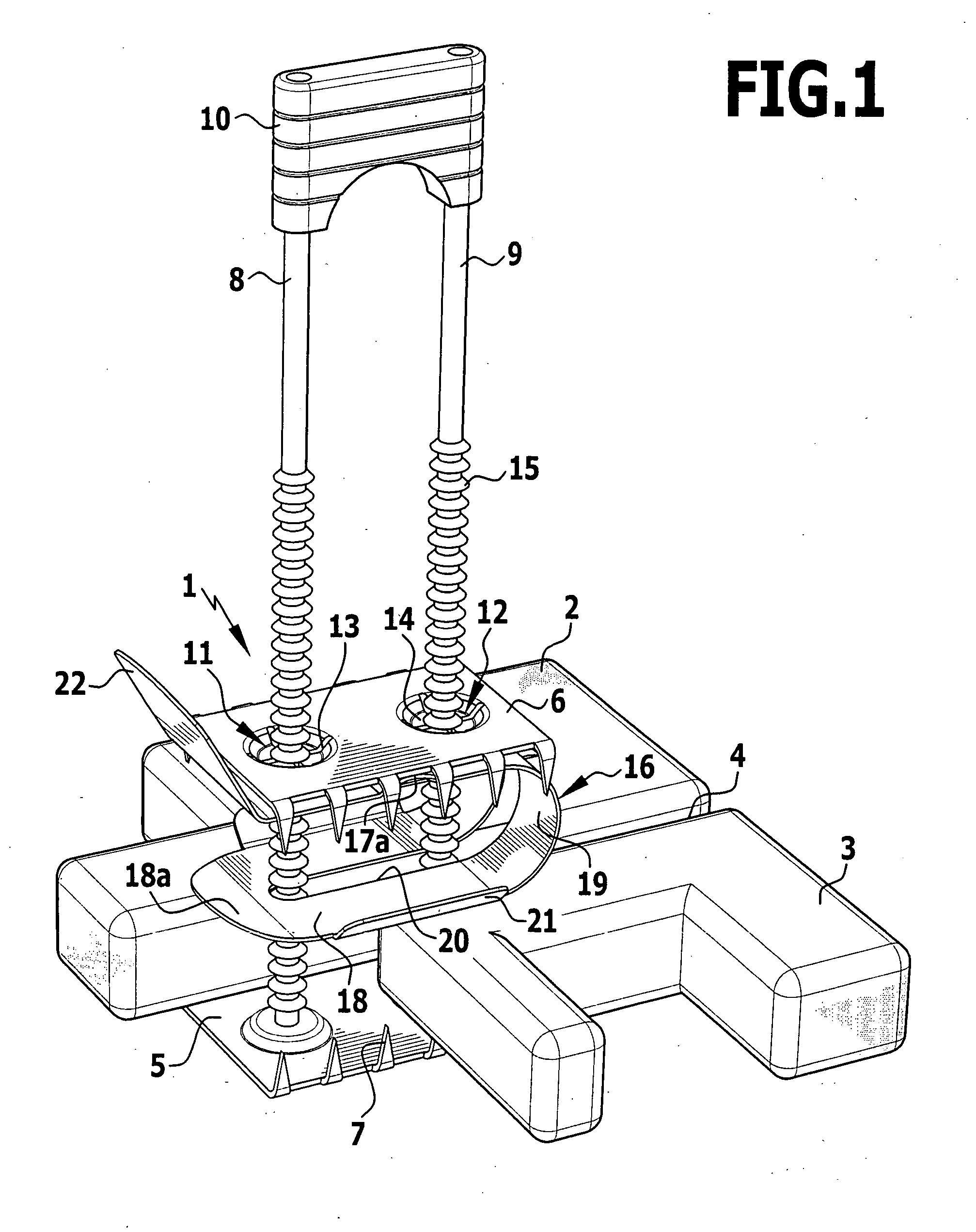 Surgical fixing device for two bone parts