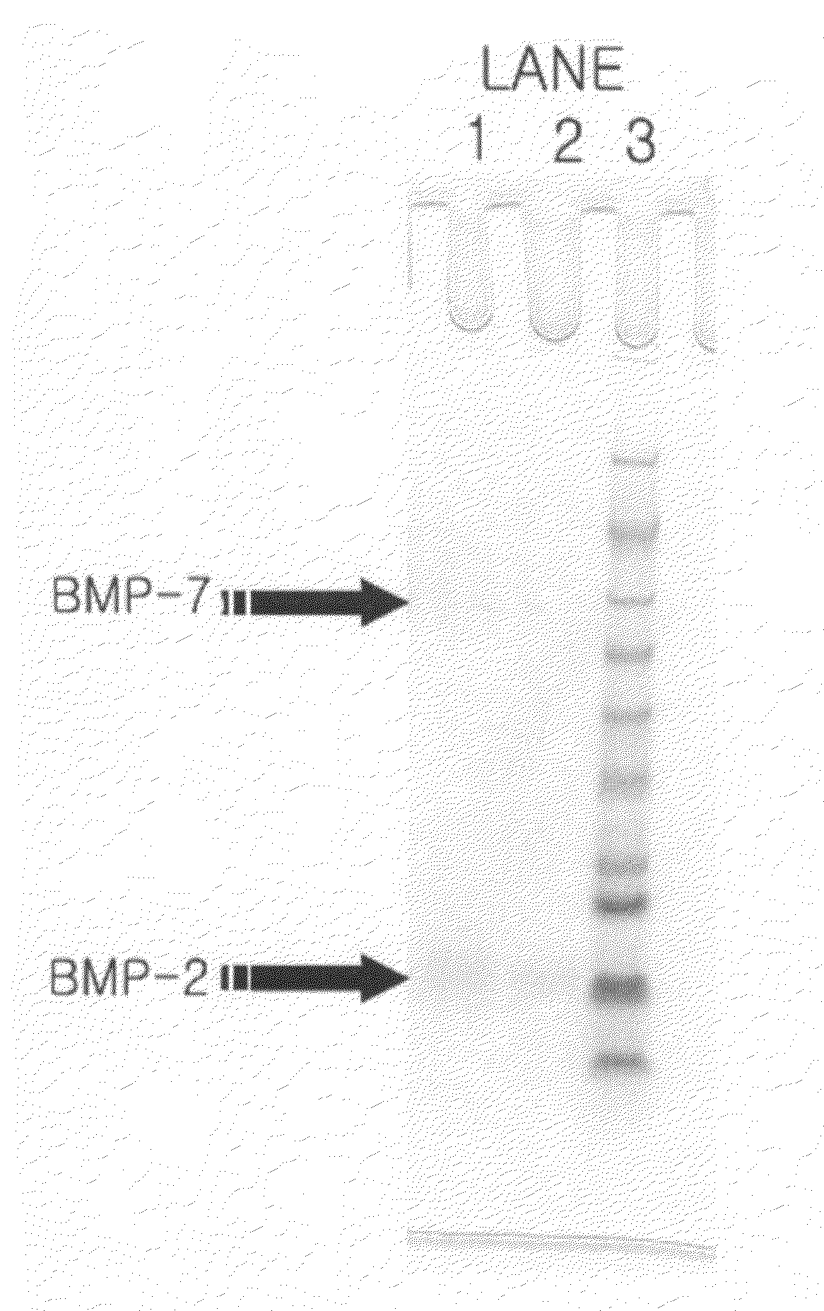 Method for producing demineralized bone matrix easily releasing bone morphogenetic protein and method for extracting bone morphogenetic protein using demineralized bone matrix by irradiation