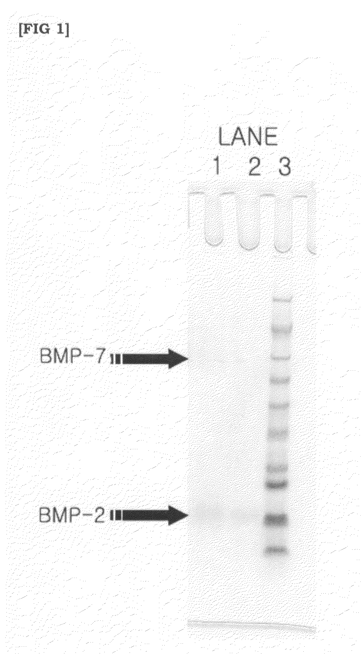 Method for producing demineralized bone matrix easily releasing bone morphogenetic protein and method for extracting bone morphogenetic protein using demineralized bone matrix by irradiation