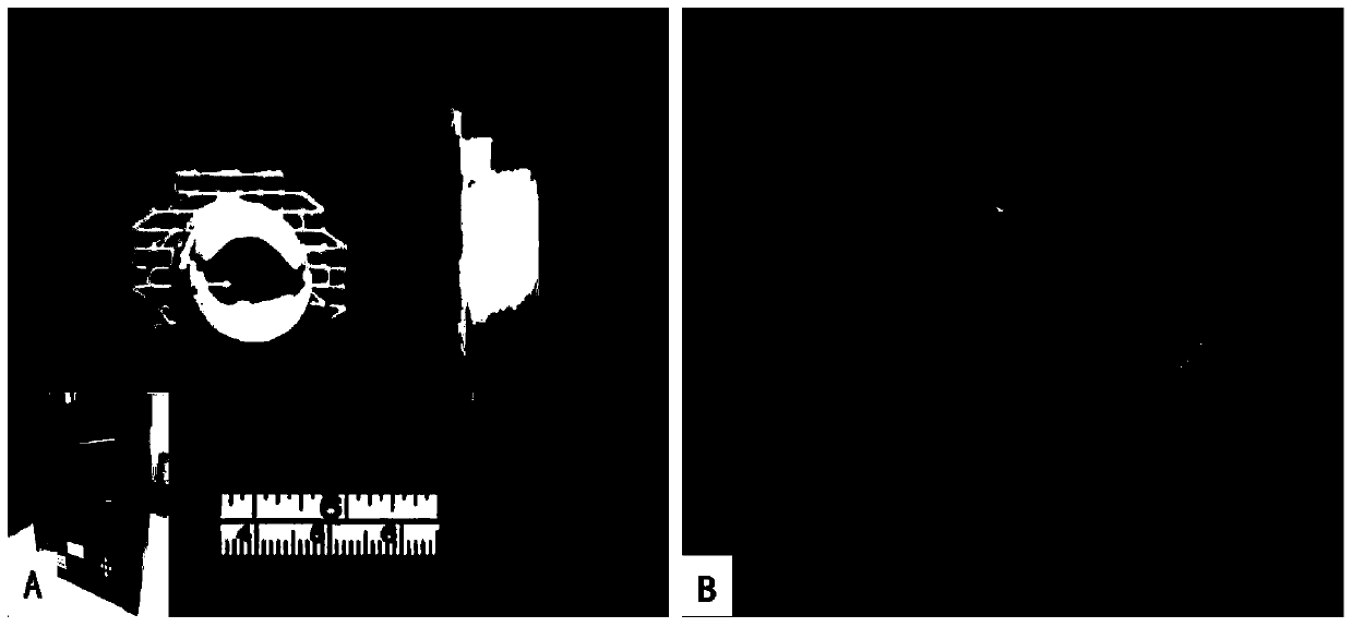 A method for constructing segmental individualized three-dimensional scaffold material for human urethra